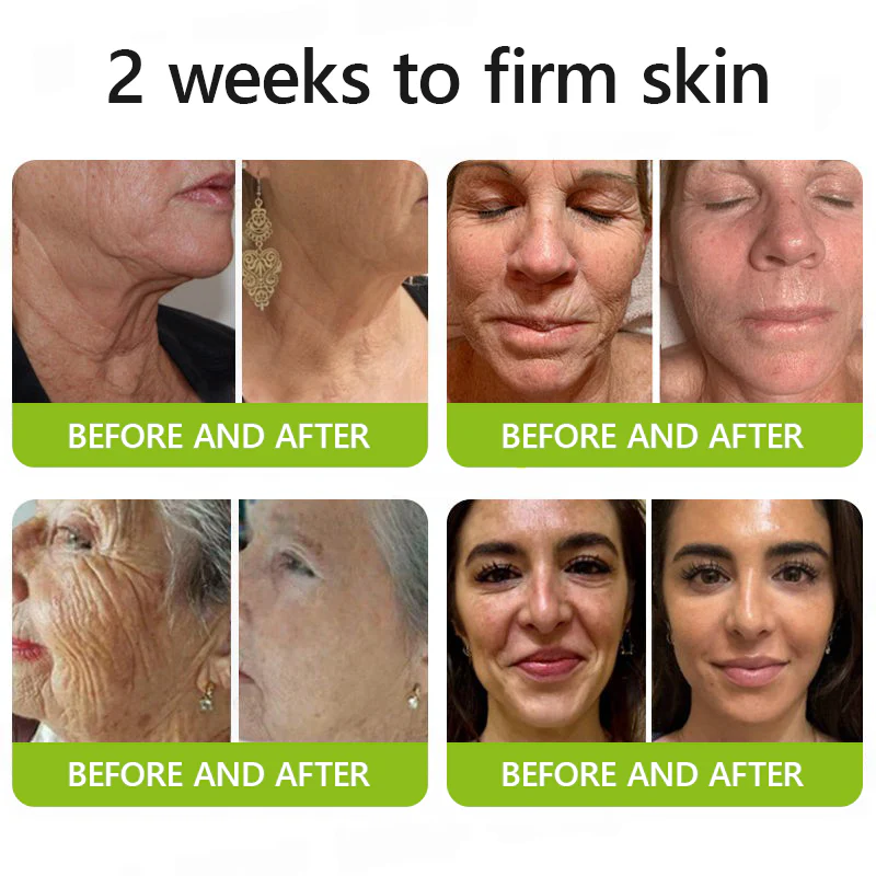 Botox & Retinol Shot - Eraser for Deep Wrinkles, Sagging Jowls & Puffy Eyes - Image 4