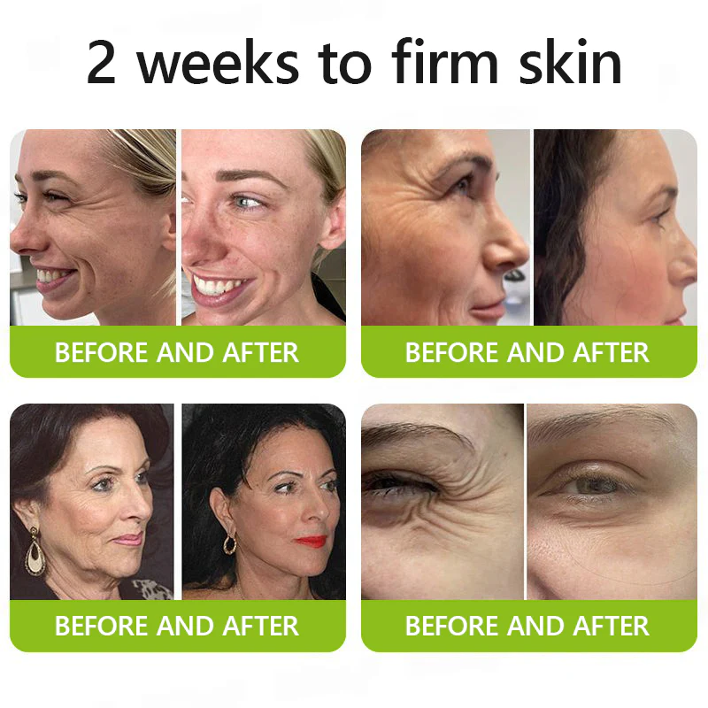 Botox & Retinol Shot - Eraser for Deep Wrinkles, Sagging Jowls & Puffy Eyes - Image 5
