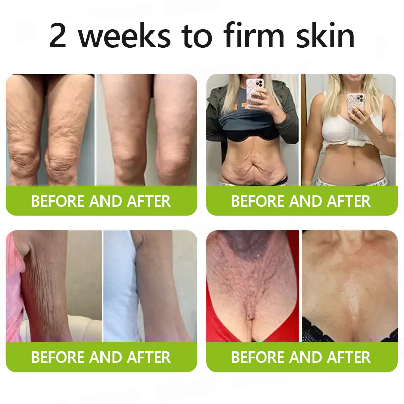 Botox & Retinol Shot - Eraser for Deep Wrinkles, Sagging Jowls & Puffy Eyes - Image 6