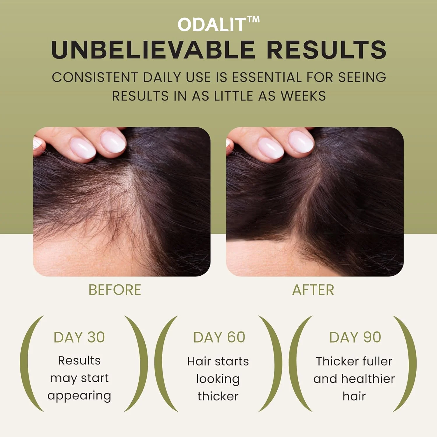 🔥LAST DAY SALE-60% OFF -ODALIT™ Wonder Growth Oil - Image 2