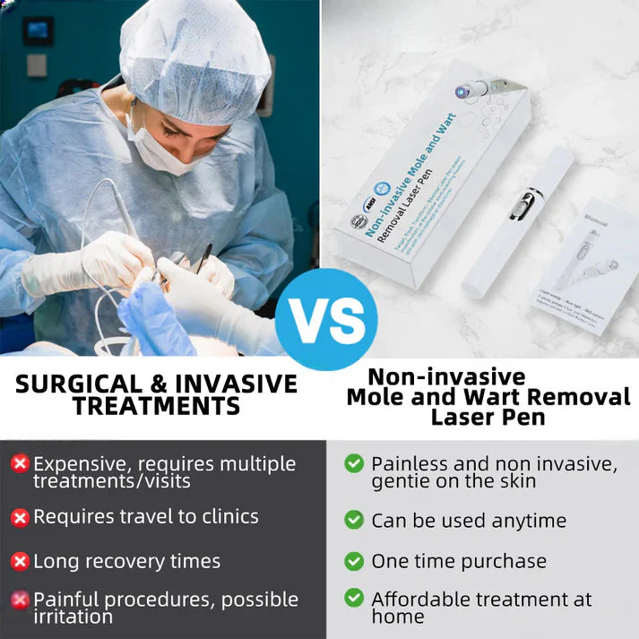 Aprolo™ Non-invasive Mole and Wart Removal Laser Pen - Image 11