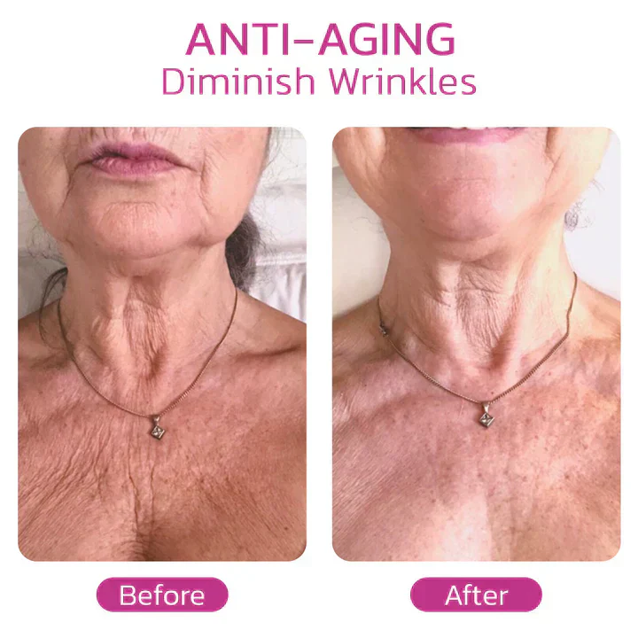 Spain NECKPON Hydrolized Collagen Neck Cream - Image 7