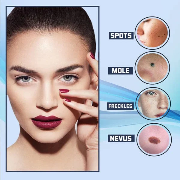 Spotfree Electric Beauty Pen - Image 2